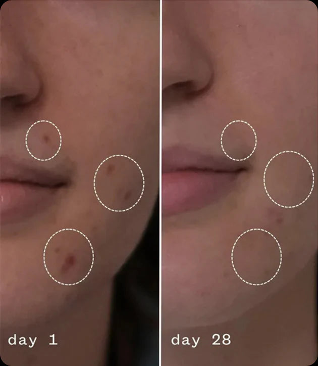 Anti-Aging Moisturizing Cream