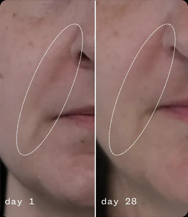 Anti-Aging Moisturizing Cream